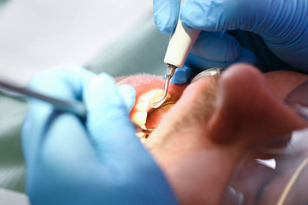 Best Emergency Dental Care for Trauma or Injury in Weslaco, TX